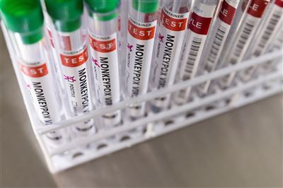 15國爆猴痘疫情 比利時宣布確診隔離21天